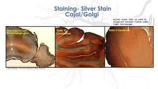 Staining- Silver Stain
Cajal/Golgi
Cajal/ Golgi Stain – University of Oklahoma College of Medicine
Silver stain that is used to
visualize nervous tissue under
light microscopy.
Silver stain that is used to
visualize nervous tissue under
light microscopy.
 