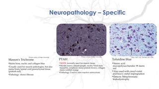 Neuropathology – Specific
PTAH
•NOTE: normally used for muscle tissue
•Myelin stains a bluish-purple, nuclei/Nissl stain
basophili, cytoplasm stains pinkish brown, collagen
stains reddish orange
•Pathology: Used to view reactive astrocytosis
Masson's Trichrome
•Stains bone, nuclei, and collagen blue
•Usually used for muscle pathologies, but also
stains brain/spinal cord parenchymal tissue
(pinkish red)
•Pathology: shows fibrosis
Toluidine blue
•Stains: acid
mucopolysaccharides  stains
red
•Also used with cresyl violet
and heavy metal impregnation
•Detects: Metachromatic
leukodystrophy
Picture curtesy of Duke UniversityPicture curtesy of Duke University Photo credit: Arai, Nobutaka, MD, DMS
 