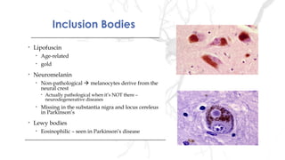 Inclusion BodiesInclusion Bodies
• Lipofuscin
• Age-related
• gold
• Neuromelanin
• Non-pathological  melanocytes derive from the
neural crest
• Actually pathological when it’s NOT there –
neurodegenerative diseases
• Missing in the substantia nigra and locus cereleus
in Parkinson’s
• Lewy bodies
• Eosinophilic – seen in Parkinson’s disease
• Lipofuscin
• Age-related
• gold
• Neuromelanin
• Non-pathological  melanocytes derive from the
neural crest
• Actually pathological when it’s NOT there –
neurodegenerative diseases
• Missing in the substantia nigra and locus cereleus
in Parkinson’s
• Lewy bodies
• Eosinophilic – seen in Parkinson’s disease
 