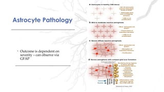 • Outcome is dependent on
severity – can observe via
GFAP
• Outcome is dependent on
severity – can observe via
GFAP
Astrocyte PathologyAstrocyte Pathology
Sofroniew & Vinters, 2010
 