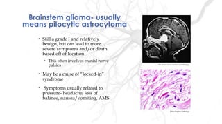Brainstem glioma- usually
means pilocytic astrocytoma
• Still a grade I and relatively
benign, but can lead to more
severe symptoms and/or death
based off of location
• This often involves cranial nerve
palsies
• May be a cause of “locked-in”
syndrome
• Symptoms usually related to
pressure- headache, loss of
balance, nausea/vomiting, AMS
The Armed Forces Institute of Pathology
Johns Hopkins Pathology
 