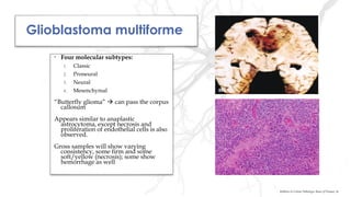 Glioblastoma multiforme
• Four molecular subtypes:
1. Classic
2. Proneural
3. Neural
4. Mesenchymal
“Butterfly glioma”  can pass the corpus
callosum
Appears similar to anaplastic
astrocytoma, except necrosis and
proliferation of endothelial cells is also
observed.
Gross samples will show varying
consistency, some firm and some
soft/yellow (necrosis); some show
hemorrhage as well
Robbins & Cotran Pathologic Basis of Disease, 9e
 