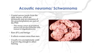 Acoustic neuroma/ SchwannomaAcoustic neuroma/ Schwannoma
• Cranial nerves (aside from the
optic nerves, which are
technically just an extension of
the procencephalon) are part of
the PNS
• This means cancer of peripheral
nerves will involve Schwann cells
instead of oligodendrocytes
• Rare (8%) and benign
• It affects women more than men
• Usually it is asymptomatic until
it grows big enough to affect
hearing
Photo credit: library.med.utah.edu
 