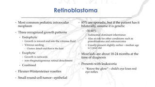 RetinoblastomaRetinoblastoma
 