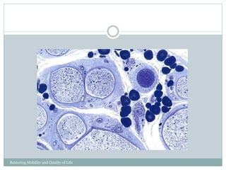 Restoring Mobility and Quality of Life
www.cpousa.com