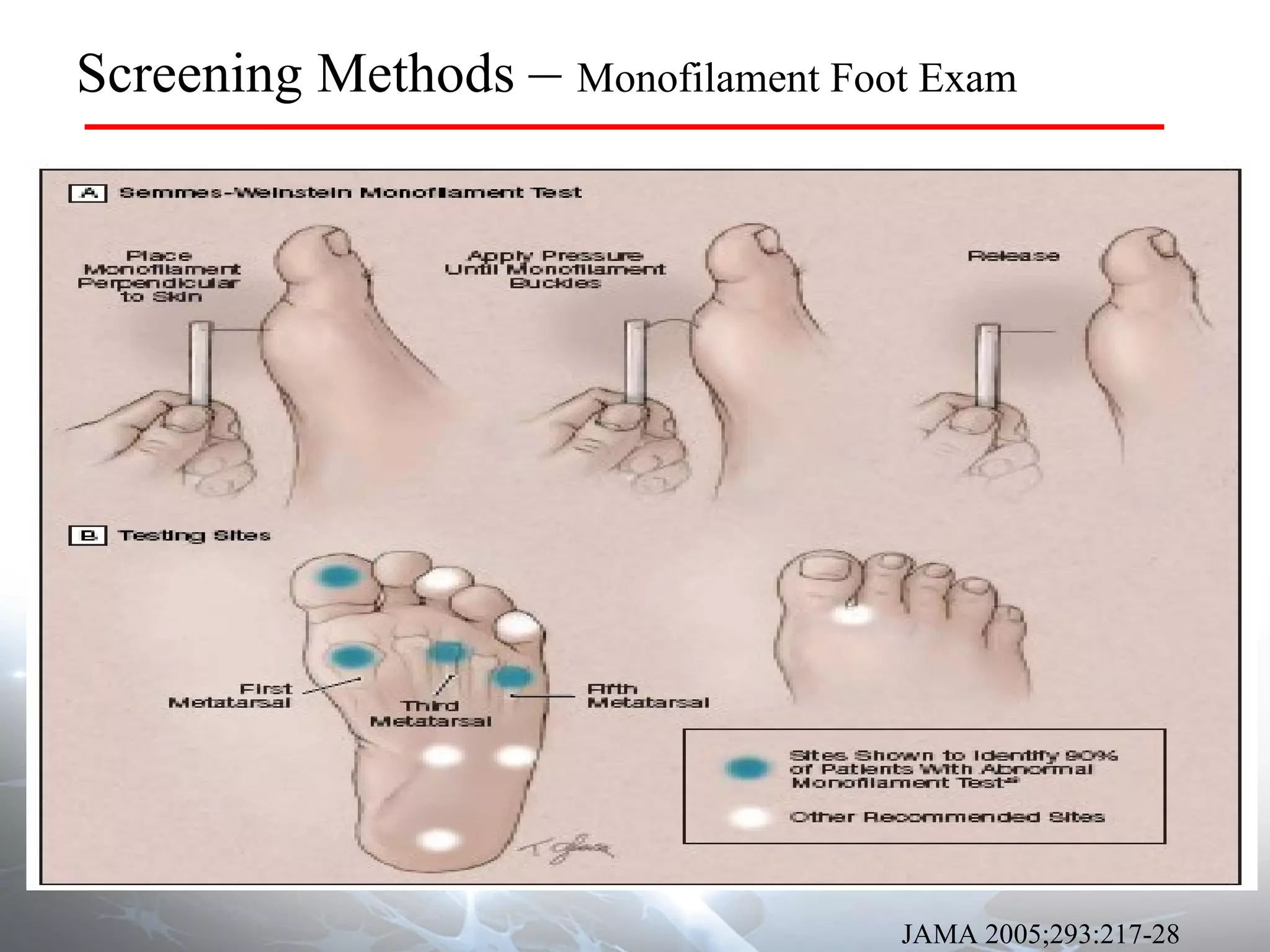 JAMA 2005;293:217-28 Screening Methods  –  Monofilament Foot Exam 