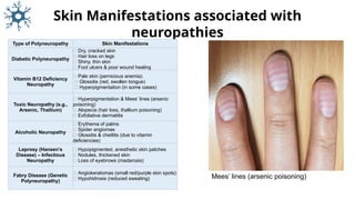 Neuropathy classifications: introduction.pptx