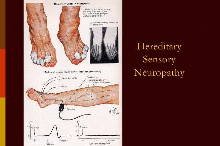 Neuropathy complete2