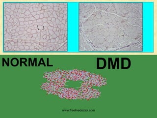 NORMAL DMD www.freelivedoctor.com 
