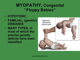 MYOPATHY , Congenital “Floppy Babies” HYPOTONIC FAMILIAL, (genetic) DISEASES MANY TYPES, in most of which the precise genetic defects have been identified www.freelivedoctor.com 