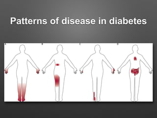 Patterns of disease in diabetes
 