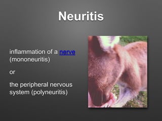 Neuritis
inflammation of a nerve
(mononeuritis)
or
the peripheral nervous
system (polyneuritis)
 