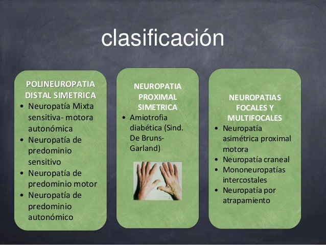 Neuropatia Neuropatia