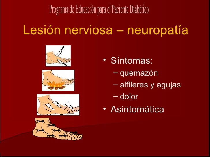 Neuropatia Diabetica Neuropatia Diabetica