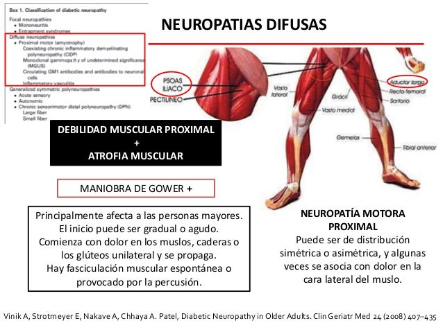 Neuropatia diabetica Neuropatia diabetica