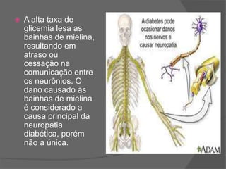  A alta taxa de
glicemia lesa as
bainhas de mielina,
resultando em
atraso ou
cessação na
comunicação entre
os neurônios. O
dano causado às
bainhas de mielina
é considerado a
causa principal da
neuropatia
diabética, porém
não a única.
 