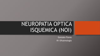 NEUROPATIA OPTICA 
ISQUEMICA (NOI) 
Gonzalo Flores 
R1 Oftalmología 
 