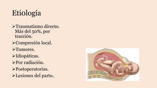 Eti0logía
Traumatismo directo.
Más del 50%, por
tracción.
Compresión local.
Tumores.
Idiopáticas.
Por radiación.
Postoperatorias.
Lesiones del parto.
 