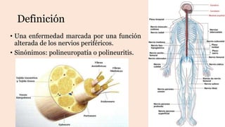 Definición
• Una enfermedad marcada por una función
alterada de los nervios periféricos.
• Sinónimos: polineuropatía o polineuritis.
 