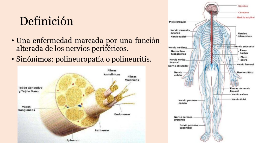 Neuropatia periferica