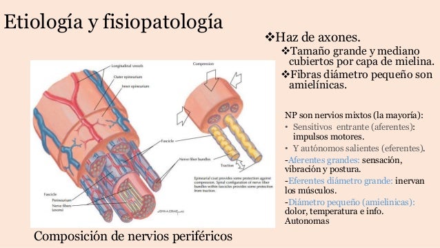 Neuropatia periferica Neuropatia periferica