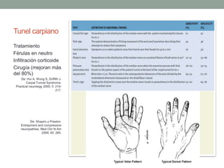 Tunel carpiano
Tratamiento
Férulas en neutro
Infiltración corticoide
Cirugía (mejoran más
del 80%)
De: Hui A, Wong S, Griffith J.
Carpal Tunnel Syndrome.
Practical neurology 2005; 5: 210-
217.
De: Shapiro y Preston.
Entrapment and compressive
neuropathies. Med Clin N Am
2009; 93: 285.
 