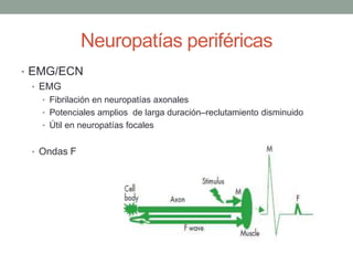 Neuropatías periféricas
• EMG/ECN
• EMG
• Fibrilación en neuropatías axonales
• Potenciales amplios de larga duración–reclutamiento disminuido
• Útil en neuropatías focales
• Ondas F
 