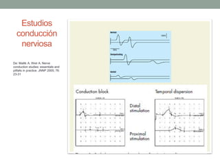 Estudios
conducción
nerviosa
De: Mallik A, Weir A. Nerve
conduction studies: essentials and
pitfalls in practice. JNNP 2005; 76:
23-31
 