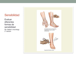 Sensibilidad
Evaluar
diferentes
formas de
sensibilidad
De: Netter’s neurology
2° edición
 