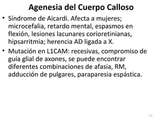 Agenesia del Cuerpo Calloso
• Síndrome de Aicardi. Afecta a mujeres;
microcefalia, retardo mental, espasmos en
flexión, lesiones lacunares corioretinianas,
hipsarritmia; herencia AD ligada a X.
• Mutación en L1CAM: recesivas, compromiso de
guía glial de axones, se puede encontrar
diferentes combinaciones de afasia, RM,
adducción de pulgares, paraparesia espástica.
13
 