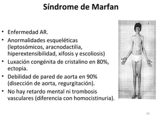 Síndrome de Marfan
• Enfermedad AR.
• Anormalidades esqueléticas
(leptosómicos, aracnodactilia,
hiperextensibilidad, xifosis y escoliosis)
• Luxación congénita de cristalino en 80%,
ectopia.
• Debilidad de pared de aorta en 90%
(disección de aorta, regurgitación).
• No hay retardo mental ni trombosis
vasculares (diferencia con homocistinuria).
30
 