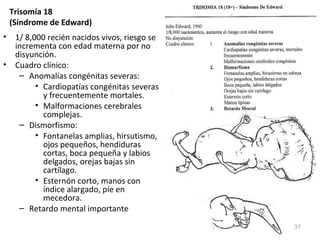 Trisomía 18
(Síndrome de Edward)
• 1/ 8,000 recién nacidos vivos, riesgo se
incrementa con edad materna por no
disyunción.
• Cuadro clínico:
– Anomalías congénitas severas:
• Cardiopatías congénitas severas
y frecuentemente mortales.
• Malformaciones cerebrales
complejas.
– Dismorfismo:
• Fontanelas amplias, hirsutismo,
ojos pequeños, hendiduras
cortas, boca pequeña y labios
delgados, orejas bajas sin
cartílago.
• Esternón corto, manos con
índice alargado, píe en
mecedora.
– Retardo mental importante
37
 
