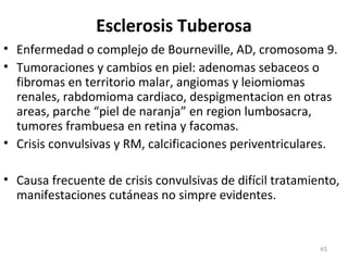 Esclerosis Tuberosa
• Enfermedad o complejo de Bourneville, AD, cromosoma 9.
• Tumoraciones y cambios en piel: adenomas sebaceos o
fibromas en territorio malar, angiomas y leiomiomas
renales, rabdomioma cardiaco, despigmentacion en otras
areas, parche “piel de naranja” en region lumbosacra,
tumores frambuesa en retina y facomas.
• Crisis convulsivas y RM, calcificaciones periventriculares.
• Causa frecuente de crisis convulsivas de difícil tratamiento,
manifestaciones cutáneas no simpre evidentes.
45
 