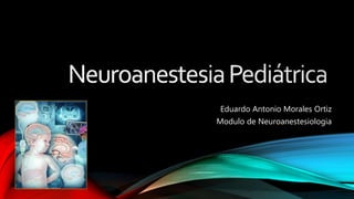 Eduardo Antonio Morales Ortiz
Modulo de Neuroanestesiologia
 