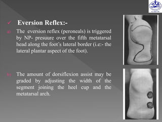  Eversion Reflex:-
a) The eversion reflex (peroneals) is triggered
by NP- presuure over the fifth metatarsal
head along the foot’s lateral border (i.e:- the
lateral plantar aspect of the foot).
b) The amount of dorsiflexion assist may be
graded by adjusting the width of the
segment joining the heel cup and the
metatarsal arch.
 