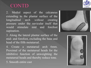 2. Medial aspect of the calcaneus
extending to the plantar surface of the
longitudinal arch without creating
pressure under the navicular itself that
would stimulate mid and forefoot
supination.
3. Along the lateral plantar surface of the
mid- and forefoot, excluding the base and
head of the fifth metatarsal.
4. Create a metatarsal arch 6mm.
Proximal of the metatarsal heads for the
inhibitive function of unweighting the
metatarsal heads and thereby reduce tone.
5. Smooth entire cast
 
