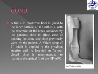  A full 1/8" plastazote liner is glued to
the inner surface of the orthosis, with
the exception of the areas contained by
the patient's shoe to allow ease of
donning the same size shoe previously
worn by the patient. A Velcro strap of
2" width is applied to the proximal
anterior calf. A lace-tied or Velcro-
closed shoe is recommended to
maintain the critical fit of the NP-AFO.
 