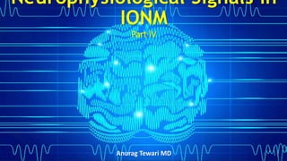 Neurophysiological Signals in
IONM
Part IV
Anurag Tewari MD 1
 
