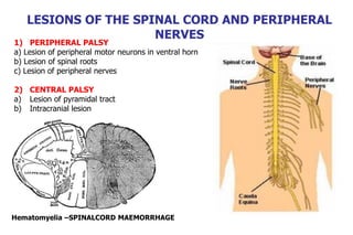 Hematomyelia –SPINALCORD MAEMORRHAGE
LESIONS OF THE SPINAL CORD AND PERIPHERAL
NERVES
1) PERIPHERAL PALSY
a) Lesion of peripheral motor neurons in ventral horn
b) Lesion of spinal roots
c) Lesion of peripheral nerves
2) CENTRAL PALSY
a) Lesion of pyramidal tract
b) Intracranial lesion
 