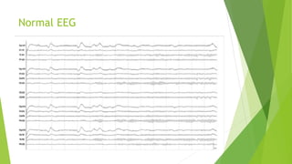 Normal EEG
 
