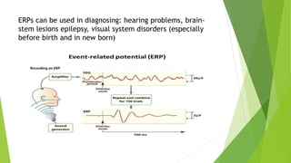 ERPs can be used in diagnosing: hearing problems, brain-
stem lesions epilepsy, visual system disorders (especially
before birth and in new born)
 