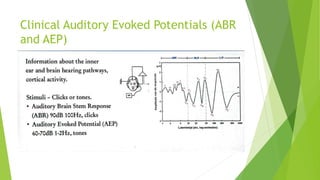 Clinical Auditory Evoked Potentials (ABR
and AEP)
 