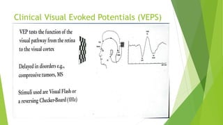 Clinical Visual Evoked Potentials (VEPS)
 