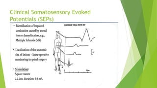 Clinical Somatosensory Evoked
Potentials (SEPs)
 