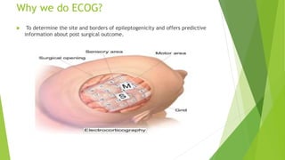 Why we do ECOG?
 To determine the site and borders of epileptogenicity and offers predictive
information about post surgical outcome.
 