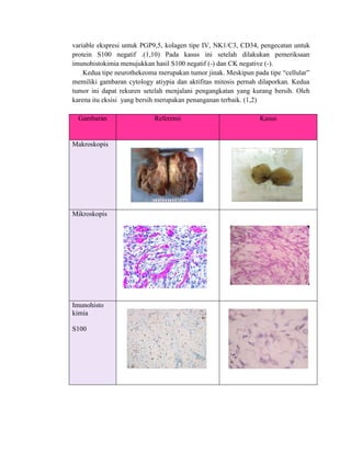 variable ekspresi untuk PGP9,5, kolagen tipe IV, NK1/C3, CD34, pengecatan untuk
protein S100 negatif .(1,10) Pada kasus ini setelah dilakukan pemeriksaan
imunohistokimia menujukkan hasil S100 negatif (-) dan CK negative (-).
Kedua tipe neurothekeoma merupakan tumor jinak. Meskipun pada tipe “cellular”
memiliki gambaran cytology atiypia dan aktifitas mitosis pernah dilaporkan. Kedua
tumor ini dapat rekuren setelah menjalani pengangkatan yang kurang bersih. Oleh
karena itu eksisi yang bersih merupakan penanganan terbaik. (1,2)
Gambaran Referensi Kasus
Makroskopis
Mikroskopis
Imunohisto
kimia
S100
 