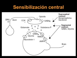 Sensibilización central 