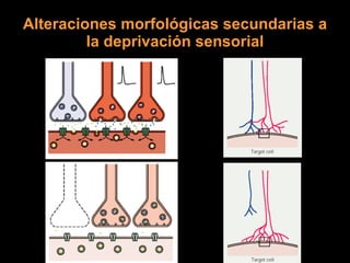 Alteraciones morfológicas secundarias a la deprivación sensorial 