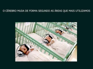 O CÉREBRO MUDA DE FORMA SEGUNDO AS ÁREAS QUE MAIS UTILIZAMOS 