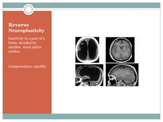 Reverse NeuroplasticityInactivity in a part of a brain, invaded by another, more active sectionCompensation, equality